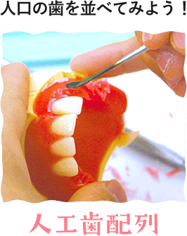人工歯配列